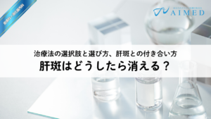 肝斑はどうしたら消える？治療法の選択肢と選び方、肝斑との付き合い方
